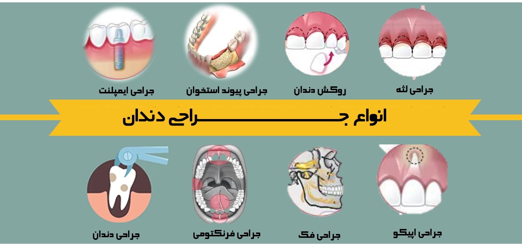 انواع جراحی‌های دهان و دندان؛