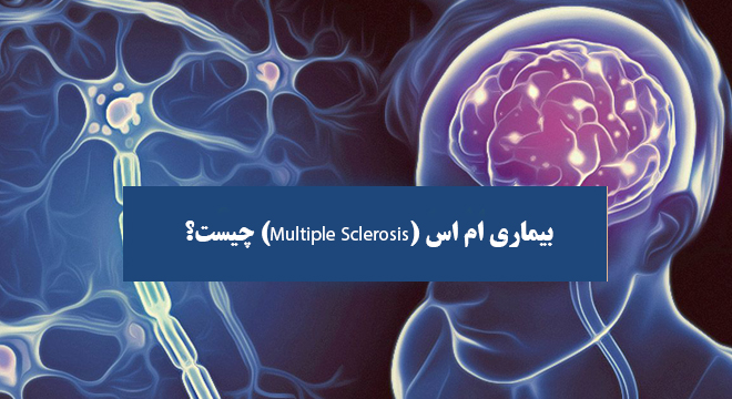 بیماری ام اس (Multiple Sclerosis) چیست؟